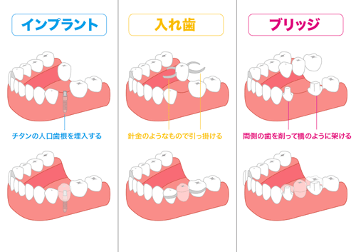 トークセラピーの利点